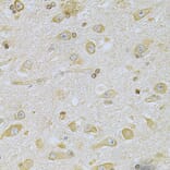 Immunohistochemistry - Anti-CAMK1D Antibody (A7512) - Antibodies.com
