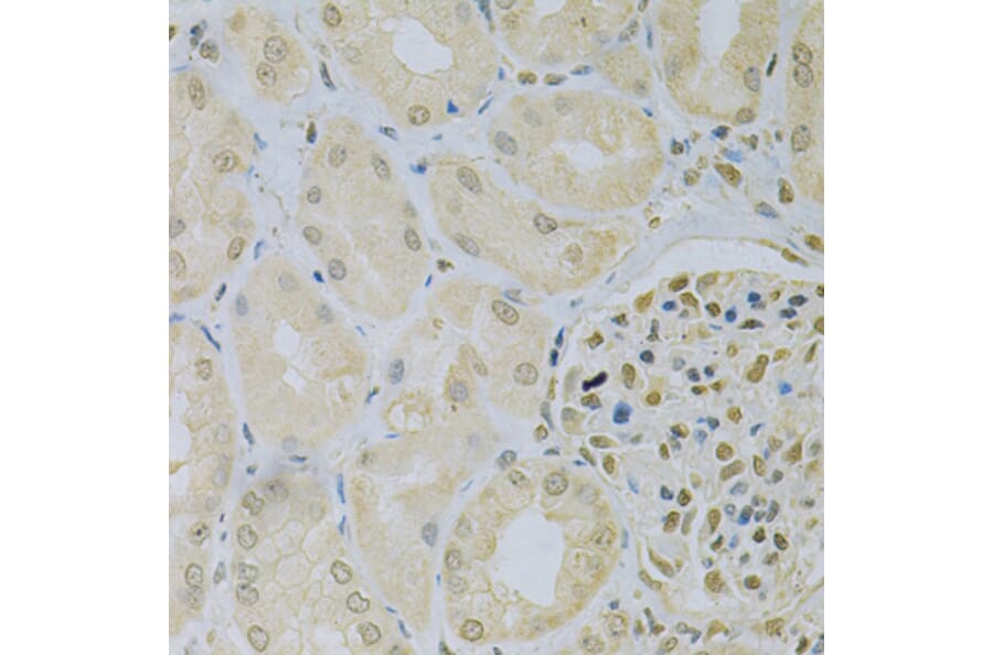 Immunohistochemistry - Anti-CAMK1D Antibody (A7512) - Antibodies.com