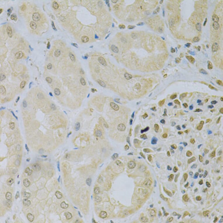 Immunohistochemistry - Anti-CAMK1D Antibody (A7512) - Antibodies.com