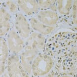 Immunohistochemistry - Anti-CAMK1D Antibody (A7512) - Antibodies.com