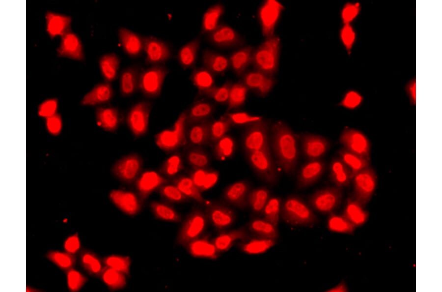 Immunofluorescence - Anti-CAMK1D Antibody (A7512) - Antibodies.com