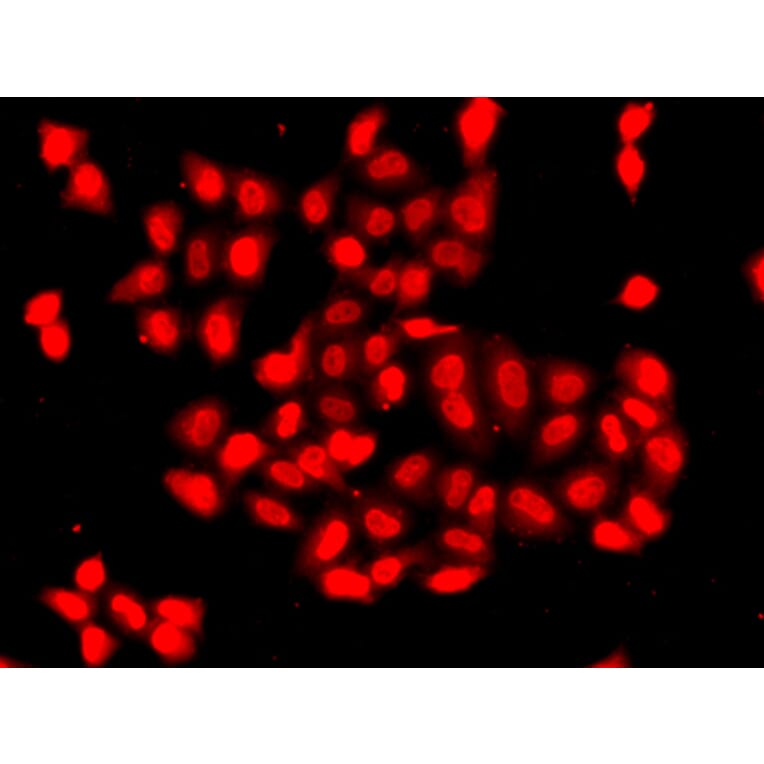 Immunofluorescence - Anti-CAMK1D Antibody (A7512) - Antibodies.com
