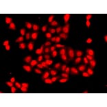 Immunofluorescence - Anti-CAMK1D Antibody (A7512) - Antibodies.com