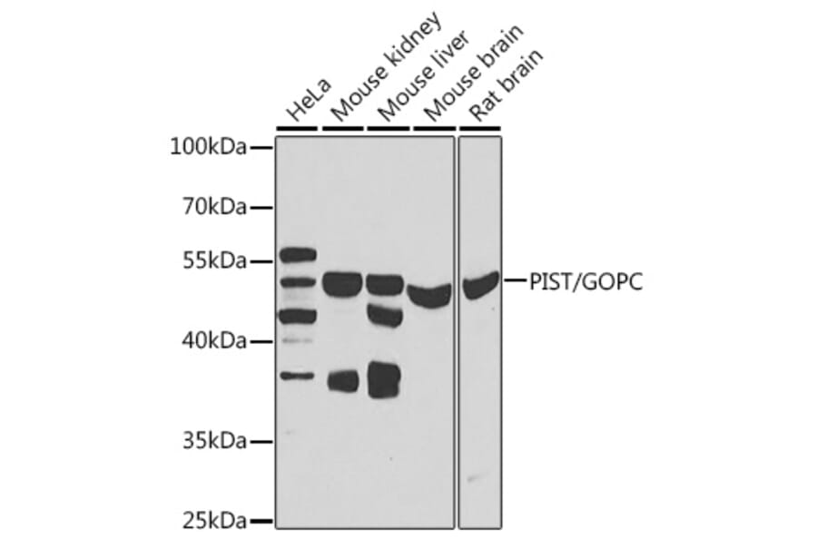 Western Blot - Anti-PIST Antibody (A15754) - Antibodies.com