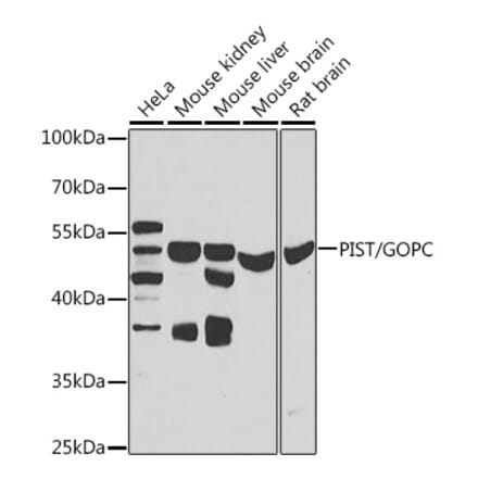 Western Blot - Anti-PIST Antibody (A15754) - Antibodies.com