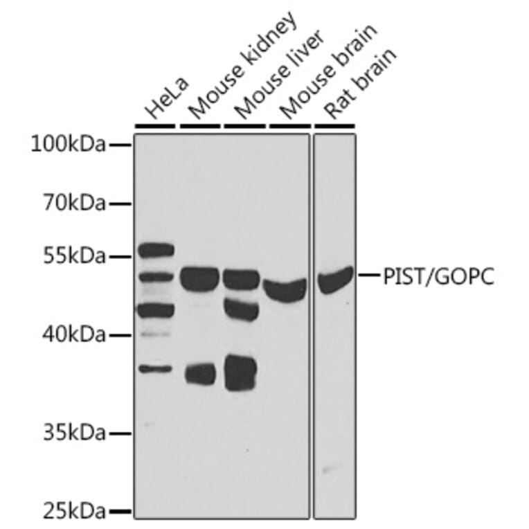 Western Blot - Anti-PIST Antibody (A15754) - Antibodies.com