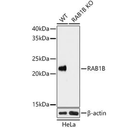 Western Blot - Anti-RAB1B Antibody (A15755) - Antibodies.com