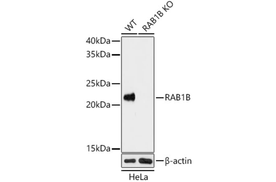 Western Blot - Anti-RAB1B Antibody (A15755) - Antibodies.com