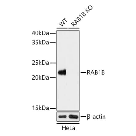 Western Blot - Anti-RAB1B Antibody (A15755) - Antibodies.com