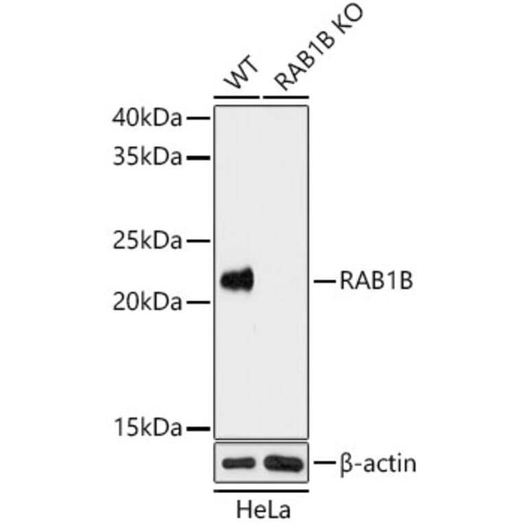Western Blot - Anti-RAB1B Antibody (A15755) - Antibodies.com