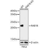 Western Blot - Anti-RAB1B Antibody (A15755) - Antibodies.com
