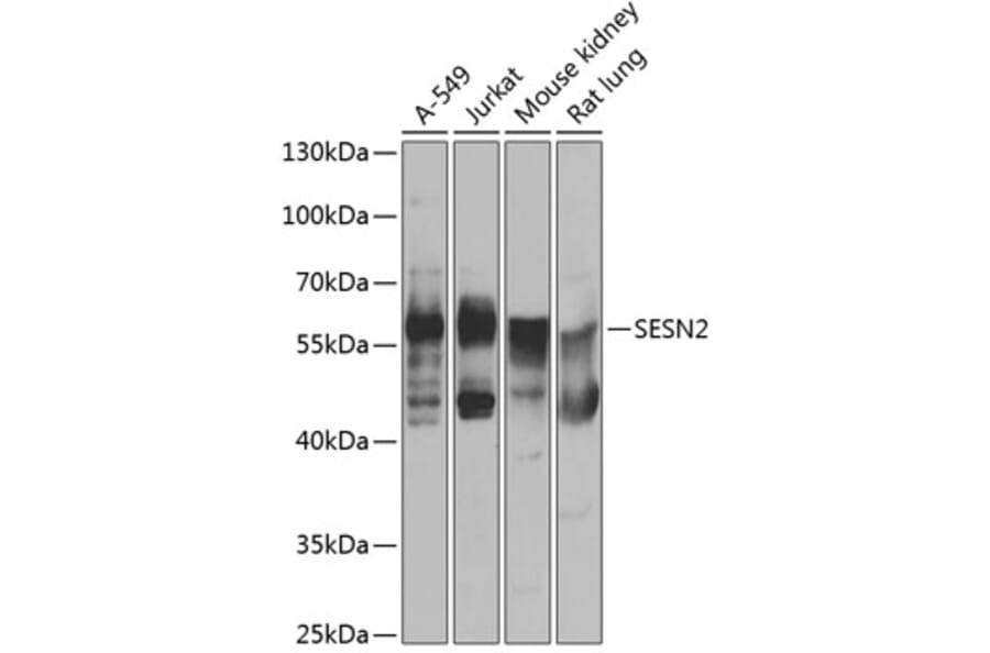 Western Blot - Anti-SESN2/Sestrin-2 Antibody (A15756) - Antibodies.com