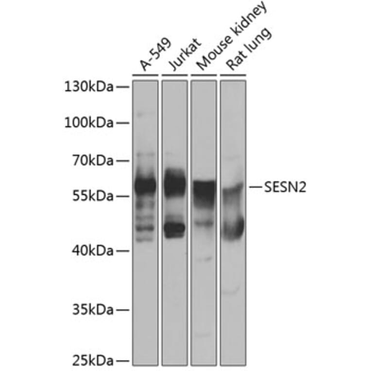 Western Blot - Anti-SESN2/Sestrin-2 Antibody (A15756) - Antibodies.com