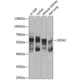 Western Blot - Anti-SESN2/Sestrin-2 Antibody (A15756) - Antibodies.com