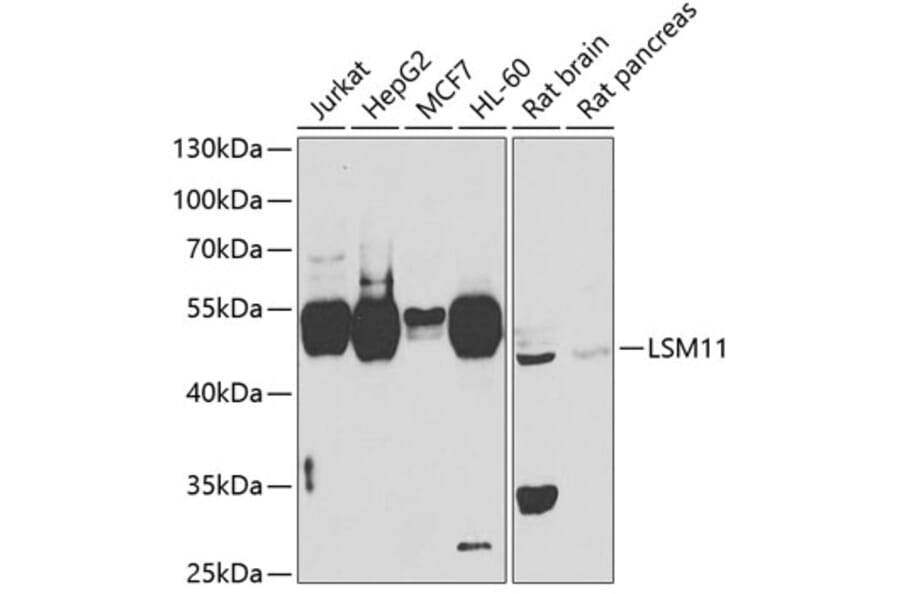 Western Blot - Anti-LSM11 Antibody (A15757) - Antibodies.com