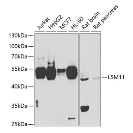 Western Blot - Anti-LSM11 Antibody (A15757) - Antibodies.com