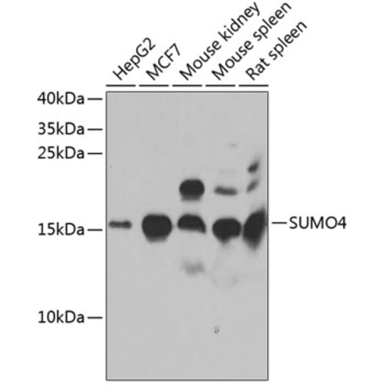 Western Blot - Anti-Sumo4 Antibody (A15758) - Antibodies.com