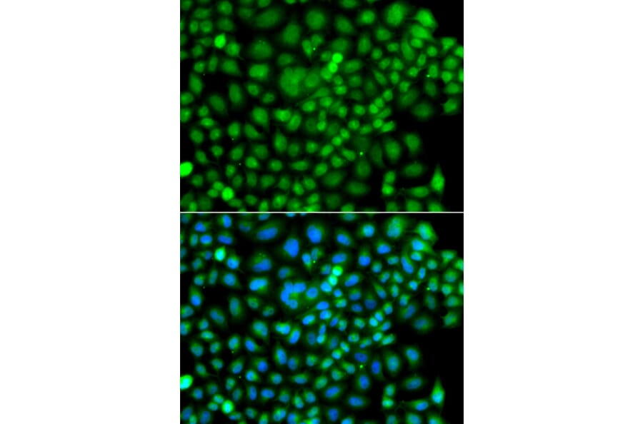 Immunofluorescence - Anti-Sumo4 Antibody (A15758) - Antibodies.com