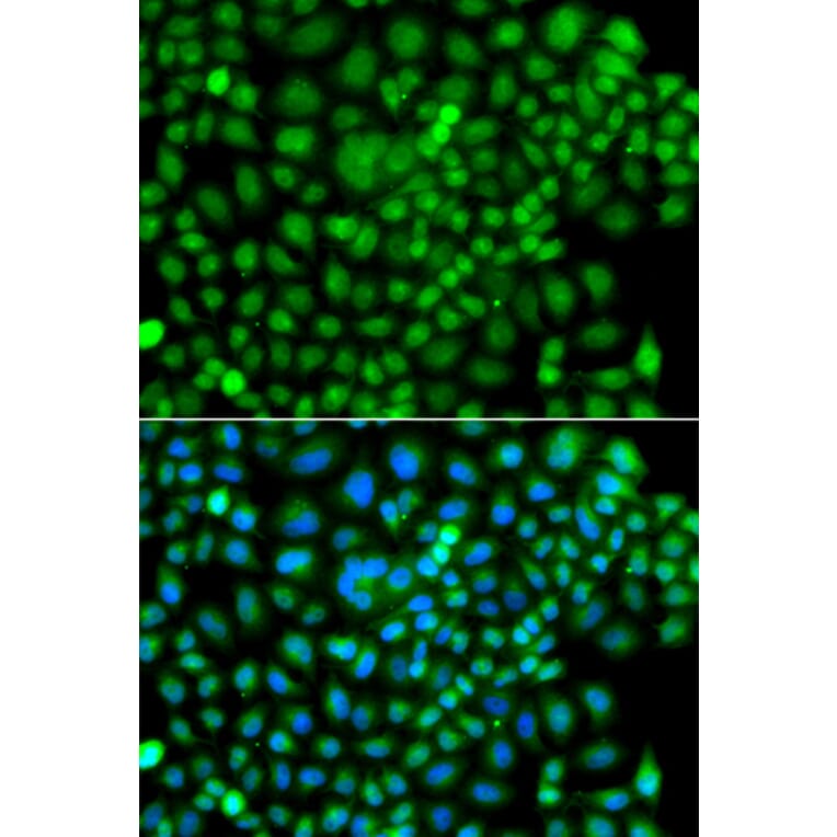 Immunofluorescence - Anti-Sumo4 Antibody (A15758) - Antibodies.com