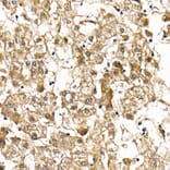 Immunohistochemistry - Anti-SMAD9 Antibody (A15759) - Antibodies.com