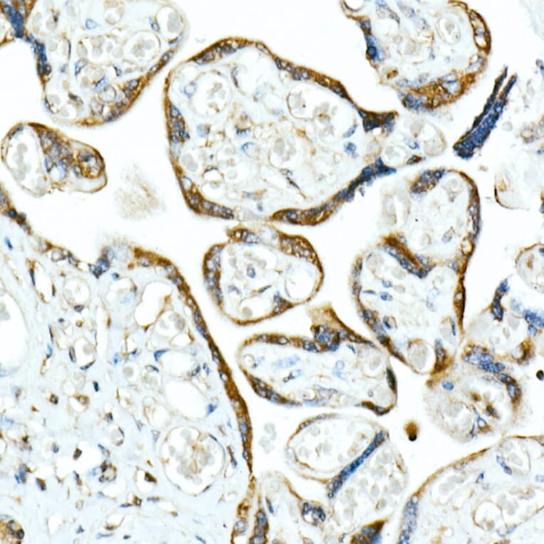 Immunohistochemistry - Anti-SMAD9 Antibody (A15759) - Antibodies.com