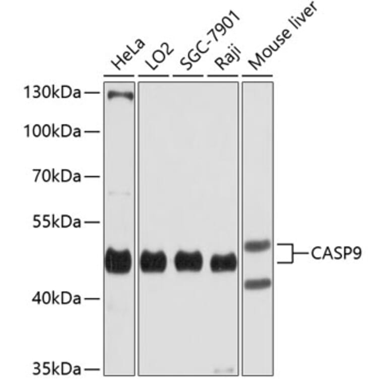 Western Blot - Anti-CASP9 Antibody (A7523) - Antibodies.com