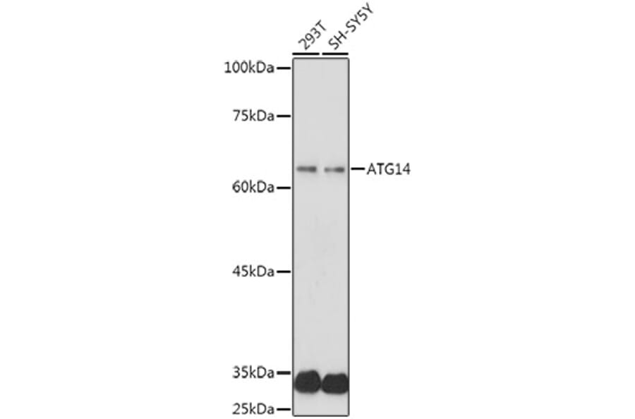 Western Blot - Anti-ATG14L Antibody (A15762) - Antibodies.com