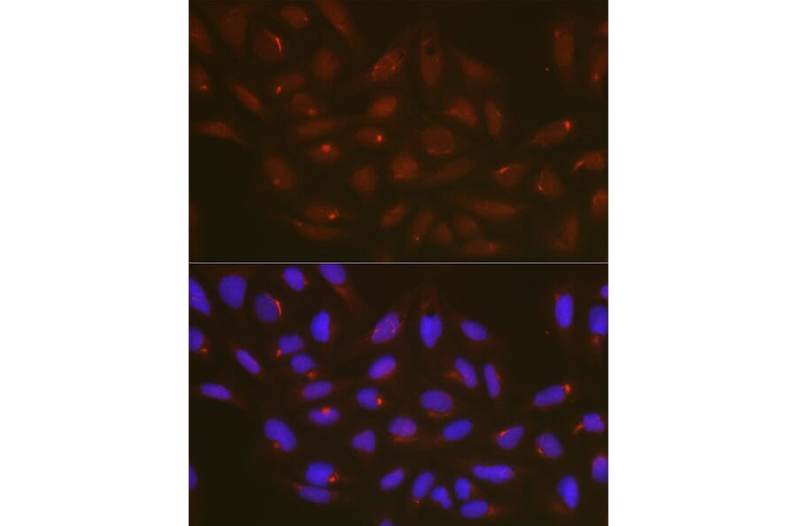 Immunofluorescence - Anti-ATG14L Antibody (A15762) - Antibodies.com