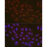 Immunofluorescence - Anti-ATG14L Antibody (A15762) - Antibodies.com