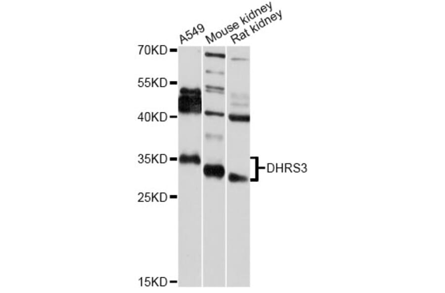 Western Blot - Anti-DHRS3 Antibody (A7530) - Antibodies.com