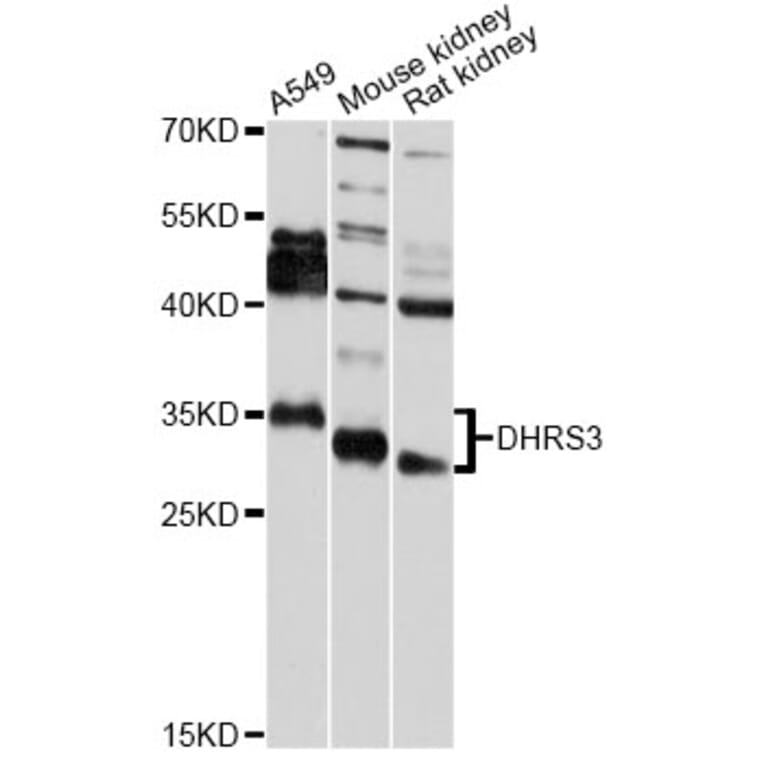 Western Blot - Anti-DHRS3 Antibody (A7530) - Antibodies.com