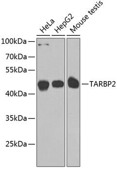Western blot analysis of extracts of various cell lines, using Anti-TARBP2 Antibody (A7533) at 1:1,000 dilution.
Secondary antibody: Goat Anti-Rabbit IgG (H+L) (HRP) (AS014) at 1:10,000 dilution.
Lysates / proteins: 25µg per lane.
Blocking buffer: 3% non-fat dry milk in TBST.
Detection: ECL Basic Kit (RM00020).
Exposure time: 90s.