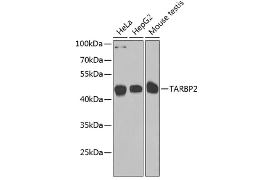 Western Blot - Anti-TRBP Antibody (A15766) - Antibodies.com
