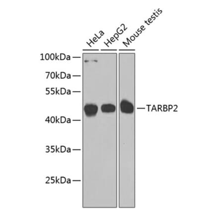 Western Blot - Anti-TRBP Antibody (A15766) - Antibodies.com