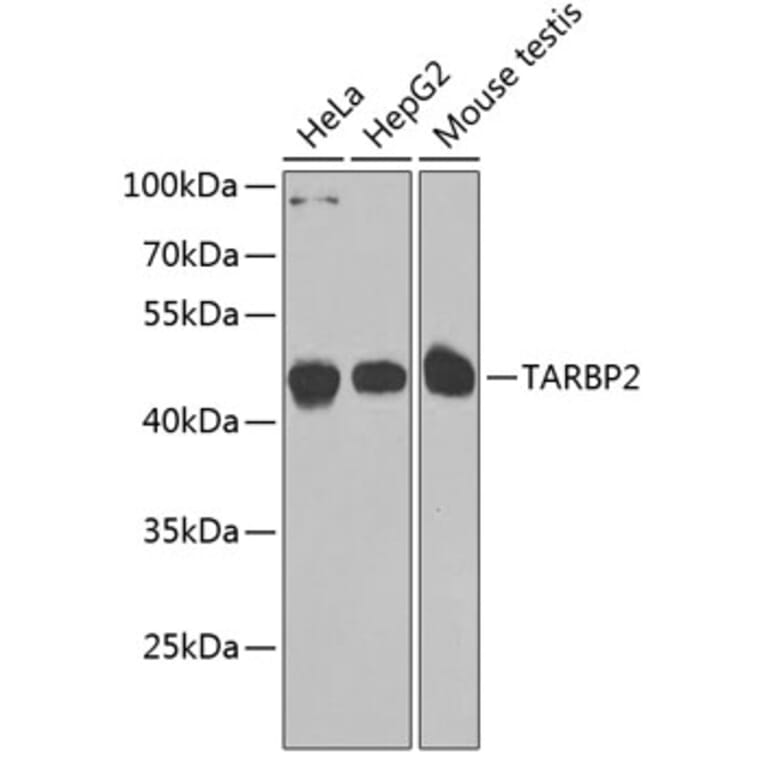 Western Blot - Anti-TRBP Antibody (A15766) - Antibodies.com