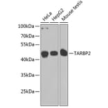 Western Blot - Anti-TRBP Antibody (A15766) - Antibodies.com