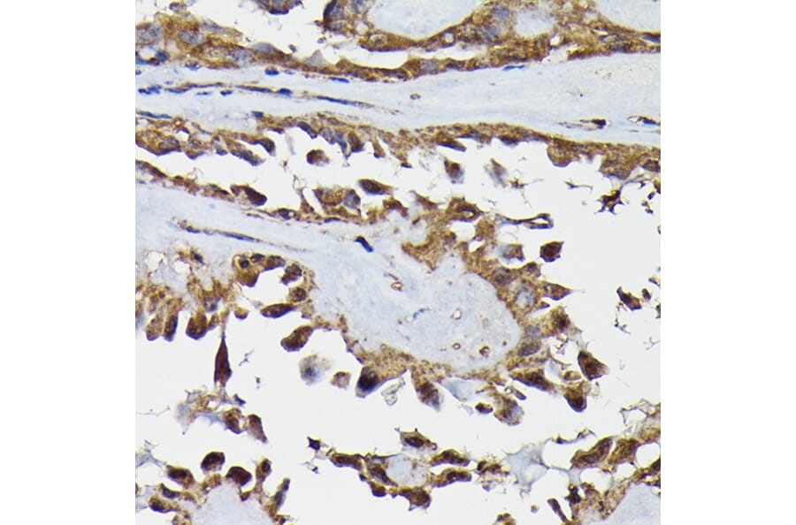 Immunohistochemistry - Anti-TRBP Antibody (A15766) - Antibodies.com