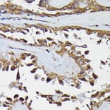 Immunohistochemistry - Anti-TRBP Antibody (A15766) - Antibodies.com