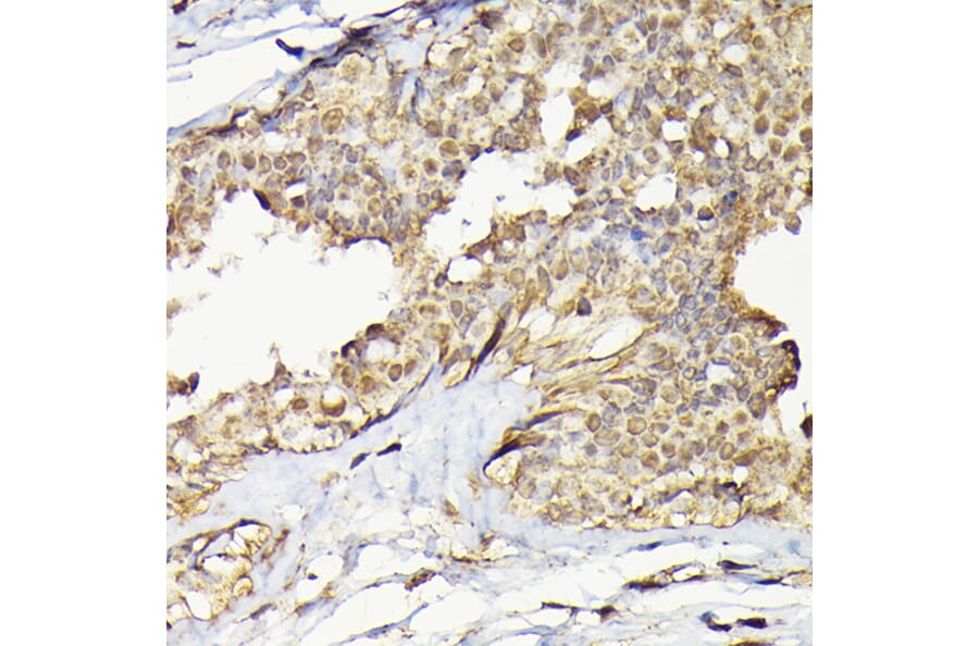 Immunohistochemistry - Anti-TRBP Antibody (A15766) - Antibodies.com
