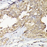 Immunohistochemistry - Anti-TRBP Antibody (A15766) - Antibodies.com