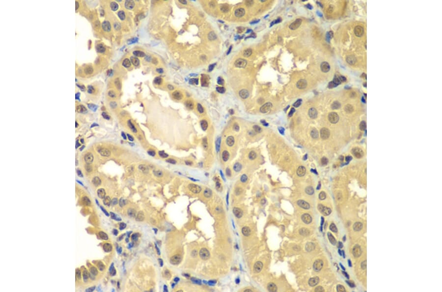 Immunohistochemistry - Anti-Smad 2 + Smad3 Antibody (A15769) - Antibodies.com