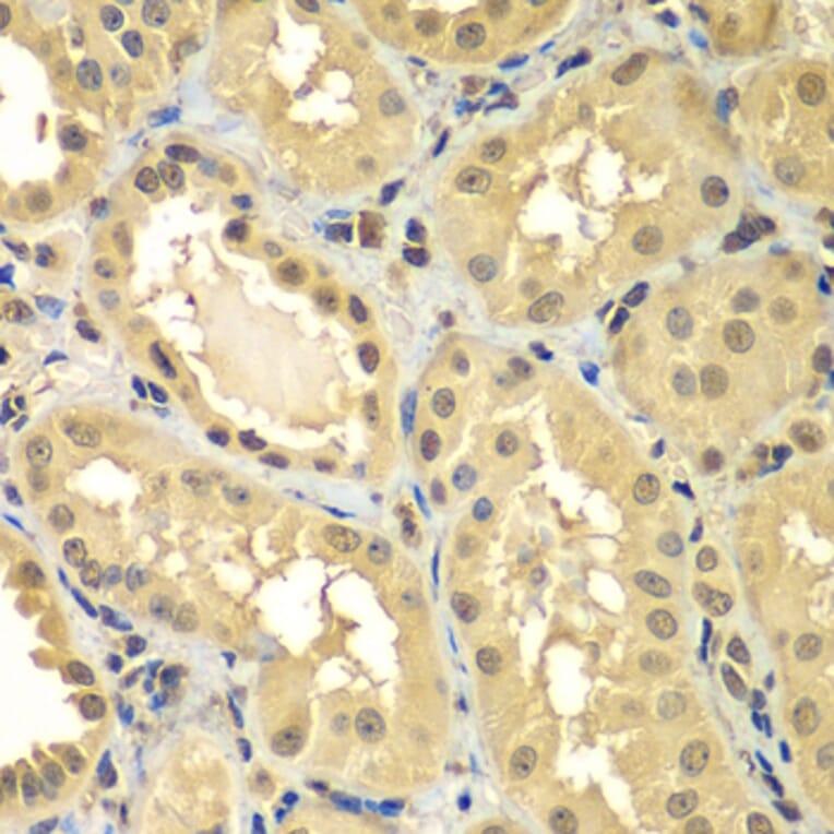 Immunohistochemistry - Anti-Smad 2 + Smad3 Antibody (A15769) - Antibodies.com