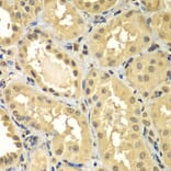 Immunohistochemistry - Anti-Smad 2 + Smad3 Antibody (A15769) - Antibodies.com