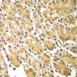 Immunohistochemistry - Anti-Smad 2 + Smad3 Antibody (A15769) - Antibodies.com
