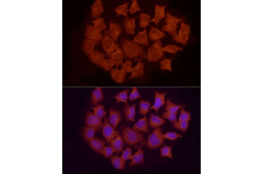 Immunofluorescence - Anti-Smad 2 + Smad3 Antibody (A15769) - Antibodies.com