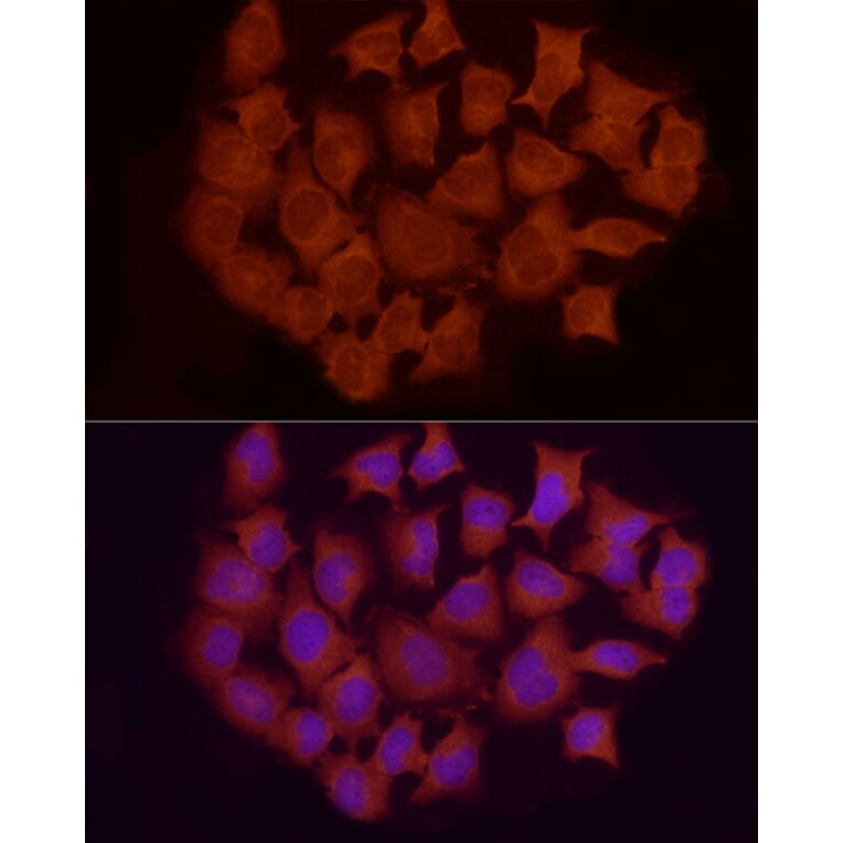 Immunofluorescence - Anti-Smad 2 + Smad3 Antibody (A15769) - Antibodies.com