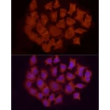 Immunofluorescence - Anti-Smad 2 + Smad3 Antibody (A15769) - Antibodies.com