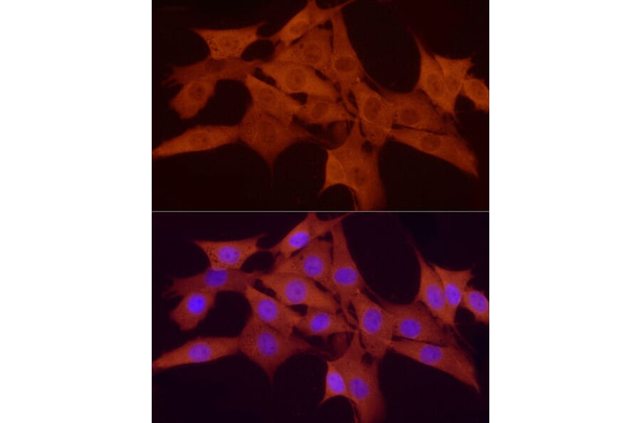 Immunofluorescence - Anti-Smad 2 + Smad3 Antibody (A15769) - Antibodies.com