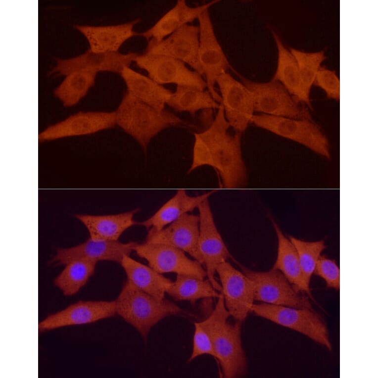 Immunofluorescence - Anti-Smad 2 + Smad3 Antibody (A15769) - Antibodies.com
