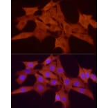 Immunofluorescence - Anti-Smad 2 + Smad3 Antibody (A15769) - Antibodies.com